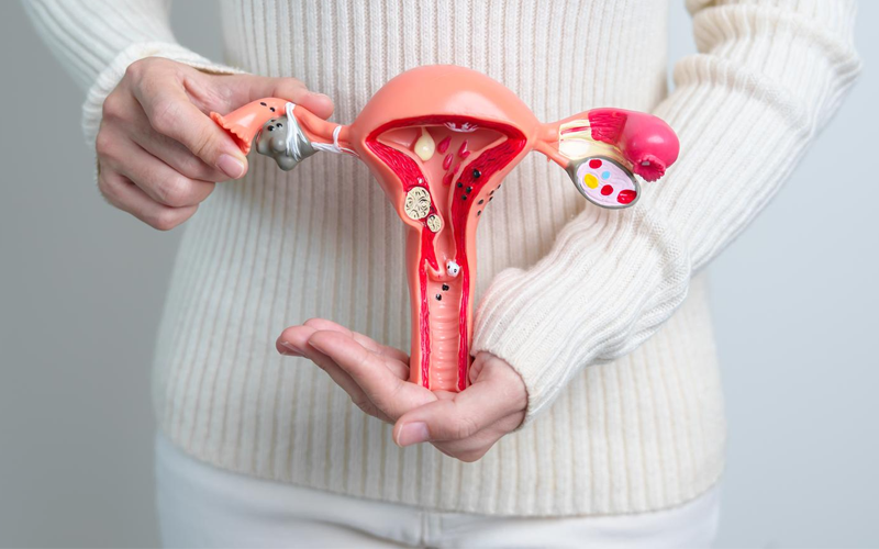 Women with Uterine or Ovarian Conditions